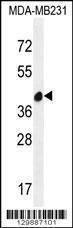 Anti-LRRC72 Rabbit Polyclonal Antibody