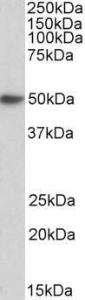 Anti-FCER1A Antibody (A85211) (0.3 µg/ml) staining of Human Peripheral Blood Lymphocytes lysate (35 µg protein in RIPA buffer). Primary incubation was 1 hour. Detected by chemiluminescence