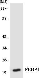 Anti-PBP Rabbit Polyclonal Antibody