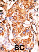 Anti-GK2 Rabbit Polyclonal Antibody (Biotin)