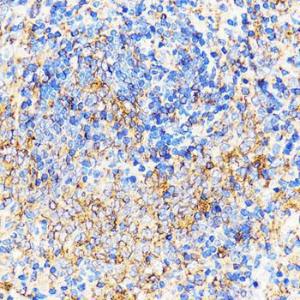 Immunohistochemistry analysis of paraffin-embedded rat spleen using Anti-CXCR2 Antibody (A9177) at a dilution of 1:100 (40x lens) Perform microwave antigen retrieval with 10 mM PBS buffer pH 72 before commencing with IHC staining protocol