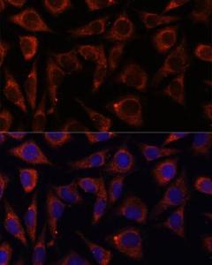 Immunofluorescence analysis of L929 cells using Anti-MRPS7 Antibody (A93261) at a dilution of 1:100. DAPI was used to stain the cell nuclei (blue).