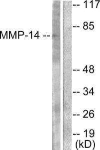 Western blot analysis of lysates from NIH/3T3 cells using Anti-MMP-14 Antibody. The right hand lane represents a negative control, where the antibody is blocked by the immunising peptide