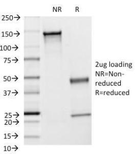 SDS-PAGE analysis of Anti-ICAM1 Antibody [F4-31C2] under non-reduced and reduced conditions; showing intact IgG and intact heavy and light chains, respectively. SDS-PAGE analysis confirms the integrity and purity of the antibody