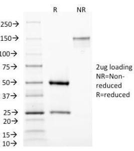 SDS-PAGE analysis of Anti-MAML3 Antibody [MAML3/1303] under non-reduced and reduced conditions; showing intact IgG and intact heavy and light chains, respectively. SDS-PAGE analysis confirms the integrity and purity of the antibody