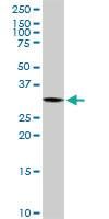 Anti-PYCR1 Rabbit Polyclonal Antibody