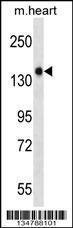 Anti-GUCY2F Rabbit Polyclonal Antibody (FITC (Fluorescein Isothiocyanate))