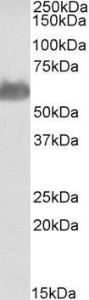 Anti-FTCD antibody