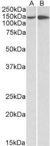 Anti-ITGA1 Antibody (A85212) (0.5 µg/ml) staining of HeLa (A) and HepG2 (B) lysates (35 µg protein in RIPA buffer). Primary incubation was 1 hour. Detected by chemiluminescence