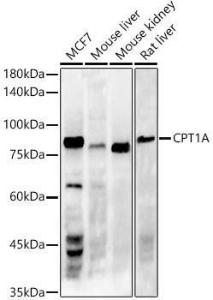 Anti-CPT1A Rabbit Monoclonal Antibody [clone: ARC51171]