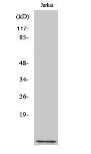 Western blot analysis of various cells using Anti-CKS1 Antibody