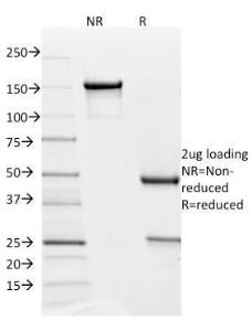 SDS-PAGE analysis of Anti-PD-L2 Antibody [PDL2/1850] under non-reduced and reduced conditions; showing intact IgG and intact heavy and light chains, respectively. SDS-PAGE analysis confirms the integrity and purity of the Antibody