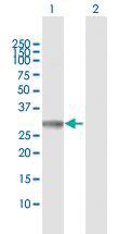 Anti-PYCR1 Rabbit Polyclonal Antibody