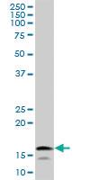 Anti-UBE2L6 Mouse Polyclonal Antibody