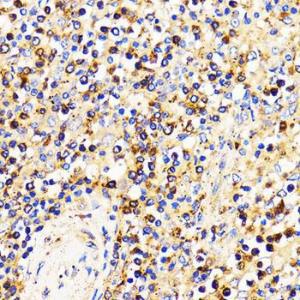 Immunohistochemistry analysis of paraffin-embedded human spleen using Anti-CXCR2 Antibody (A9177) at a dilution of 1:100 (40x lens) Perform microwave antigen retrieval with 10 mM PBS buffer pH 72 before commencing with IHC staining protocol