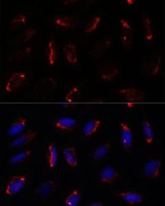 Immunofluorescence analysis of U-2 OS cells using Anti-MRPS7 Antibody (A93261) at a dilution of 1:100. DAPI was used to stain the cell nuclei (blue).