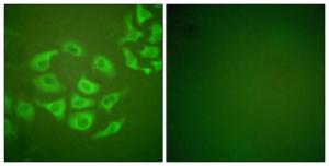 Immunofluorescence analysis of HepG2 cells using Anti-MMP-10 Antibody. The right hand panel represents a negative control, where the antibody was pre-incubated with the immunising peptide