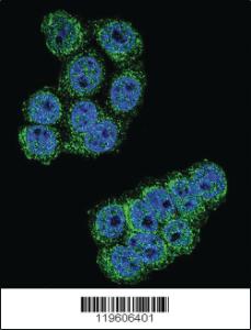 Anti-DPP3 Rabbit Polyclonal Antibody [clone: 137CT26.1.1]