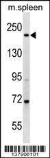 Anti-MYH7 Rabbit Polyclonal Antibody (HRP (Horseradish Peroxidase))