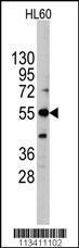 Anti-ALPI Rabbit Polyclonal Antibody