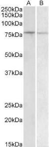 Anti-BACH1 Antibody (A83552) (1 µg/ml) staining of Human Peripheral Blood Lymphocytes (A) and Human Spleen (B) lysate (35 µg protein in RIPA buffer) Primary incubation was 1 hour Detected by chemiluminescence