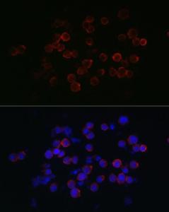 Immunofluorescence analysis of Jurkat cells using Anti-CXCR2 Antibody (A9177) at a dilution of 1:200 (40x lens) DAPI was used to stain the cell nuclei (blue)