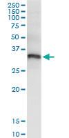 Anti-PYCR1 Rabbit Polyclonal Antibody