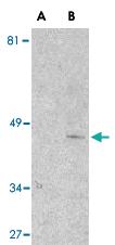 Anti-IL1RL1 Rabbit Polyclonal Antibody