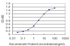 Anti-UBQLN2 Mouse Monoclonal Antibody [clone: 5F5]