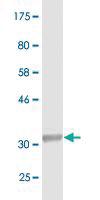 Anti-SLC25A6 Mouse Monoclonal Antibody [clone: 4B9]