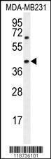 Anti-AMACR Rabbit Polyclonal Antibody (FITC (Fluorescein Isothiocyanate))