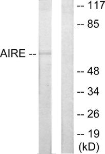 Western blot analysis of lysates from 293 cells using Anti-AIRE Antibody. The right hand lane represents a negative control, where the antibody is blocked by the immunising peptide.