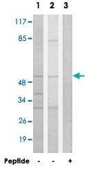 Anti-ACOT2 Rabbit Polyclonal Antibody