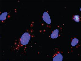 Anti-TNFRSF1A + TRAF2 Antibody Pair