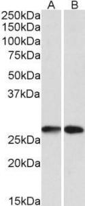 Anti-NNMT Antibody (A85214) (0.1µg/ml) staining of A549 (A) and HeLA (B) lysates (35µg protein in RIPA buffer). Primary incubation was 1 hour. Detected by chemiluminescence.