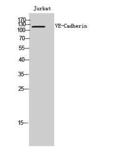 Western blot analysis of Jurkat cells using Anti-VE-Cadherin Antibody