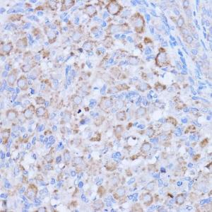 Immunohistochemistry analysis of paraffin-embedded rat ovary using Anti-MT-ND1 Antibody (A93262) at a dilution of 1:100 (40x lens). Perform microwave antigen retrieval with 10 mM PBS buffer pH 7.2 before commencing with IHC staining protocol