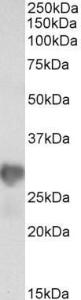 Anti-NNMT Antibody (A85215) (0.3 µg/ml) staining of HeLa lysate (35 µg protein in RIPA buffer). Primary incubation was 1 hour. Detected by chemilu minescence