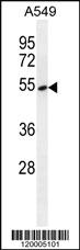 Anti-TDP2 Rabbit Polyclonal Antibody [clone: 139CT1.1.5]