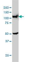 Anti-GART Mouse Monoclonal Antibody [clone: 4D6-1D5]