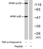 Anti-NFKB1 Rabbit Polyclonal Antibody