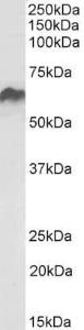 Antibody anti-HSPD1 100 µg