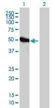 Anti-GART Mouse Monoclonal Antibody [clone: 4D6-1D5]