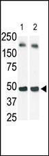 Anti-SPHK1 Rabbit Polyclonal Antibody