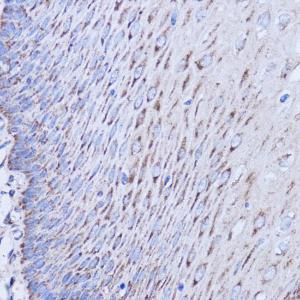 Immunohistochemistry analysis of paraffin-embedded human esophageal using Anti-MT-ND1 Antibody (A93262) at a dilution of 1:100 (40x lens). Perform microwave antigen retrieval with 10 mM PBS buffer pH 7.2 before commencing with IHC staining protocol