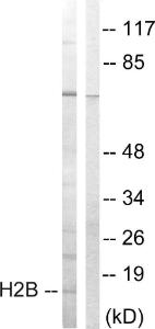 Western blot analysis of lysates from Jurkat cells, treated with UV 15' using Anti-Histone H2B Antibody. The right hand lane represents a negative control, where the antibody is blocked by the immunising peptide.