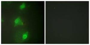 Immunofluorescence analysis of HeLa cells using Anti-AIRE Antibody. The right hand panel represents a negative control, where the antibody was pre-incubated with the immunising peptide.