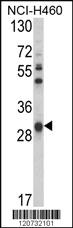 Anti-GSTO1 Rabbit Polyclonal Antibody