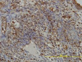 Anti-GART Mouse Monoclonal Antibody [clone: 4D6-1D5]