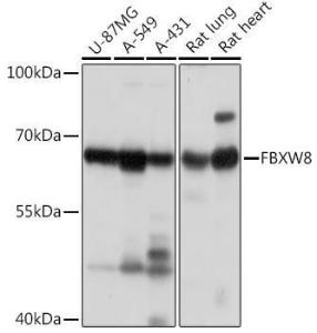 Western blot analysis of extracts of various cell lines, using Anti-FBXW8 Antibody (A309160) at 1:1,000 dilution The secondary antibody was Goat Anti-Rabbit IgG H&L Antibody (HRP) at 1:10,000 dilution Lysates/proteins were present at 25 µg per lane